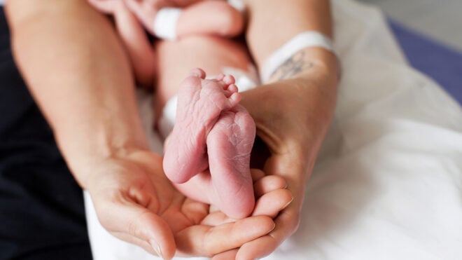 what is the cause of premature birth